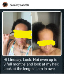 Natural Hair Growth Set
